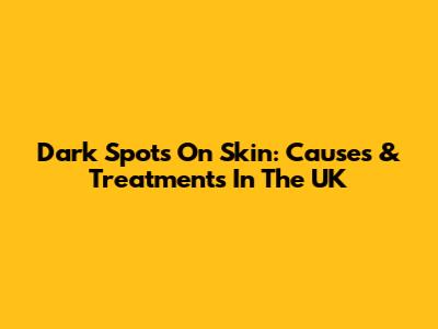 Dark Spots On Skin: Causes & Treatments In The UK