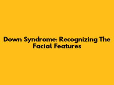 Down Syndrome: Recognizing The Facial Features