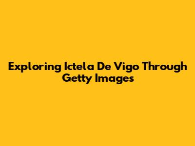 Exploring Ictela De Vigo Through Getty Images