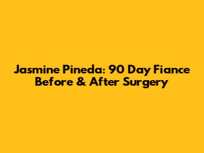 Jasmine Pineda: 90 Day Fiance Before & After Surgery