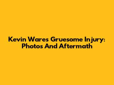 Kevin Ware's Gruesome Injury: Photos And Aftermath