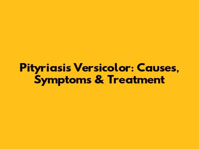 Pityriasis Versicolor: Causes, Symptoms & Treatment