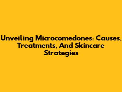 Unveiling Microcomedones: Causes, Treatments, And Skincare Strategies